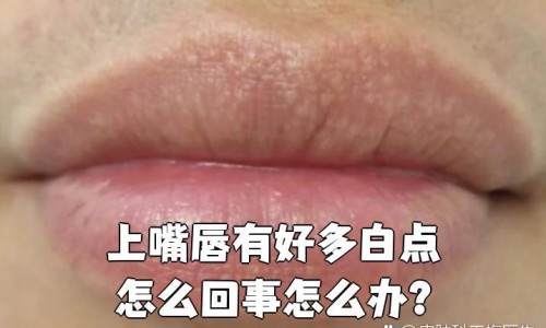 月经期间能喝银耳羹吗-月经期间能喝银耳汤吗网 :分享经期可以喝银耳-月经期间能喝银耳汤吗知识